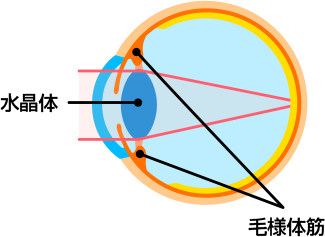 老眼の原因 水晶体硬化
