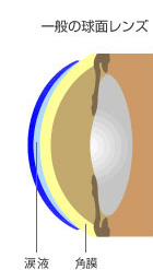 一般の球面レンズ 周辺部からの光が一点に集まりにくく、周囲がぼやけたり、像がゆがんだ
